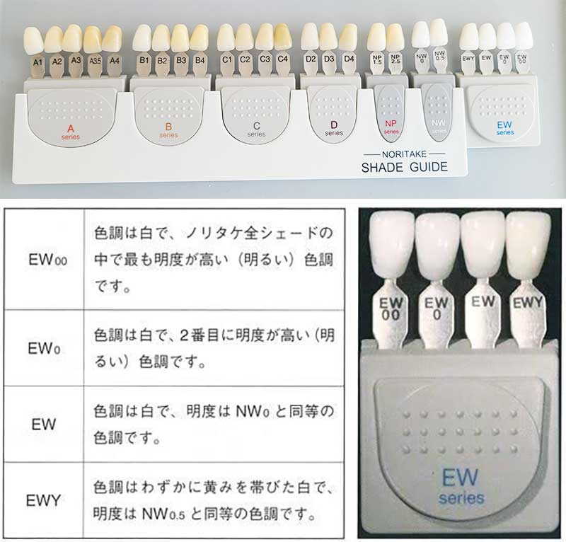 ノリタケジルコニアセラミックのシェード（ホワイトカラー）