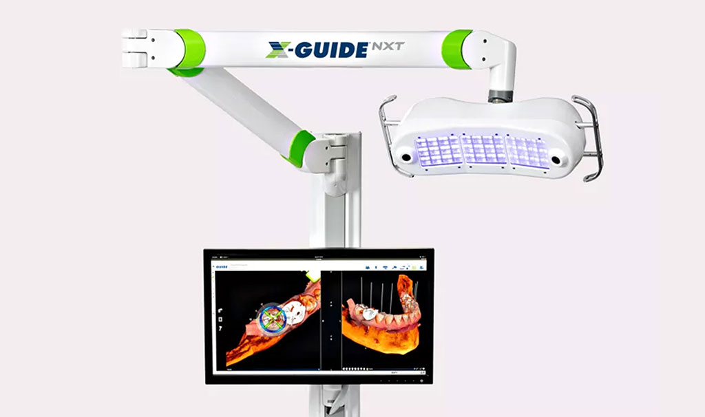 リアルタイムの3Dガイダンスによるフリーハンド・サージェリー