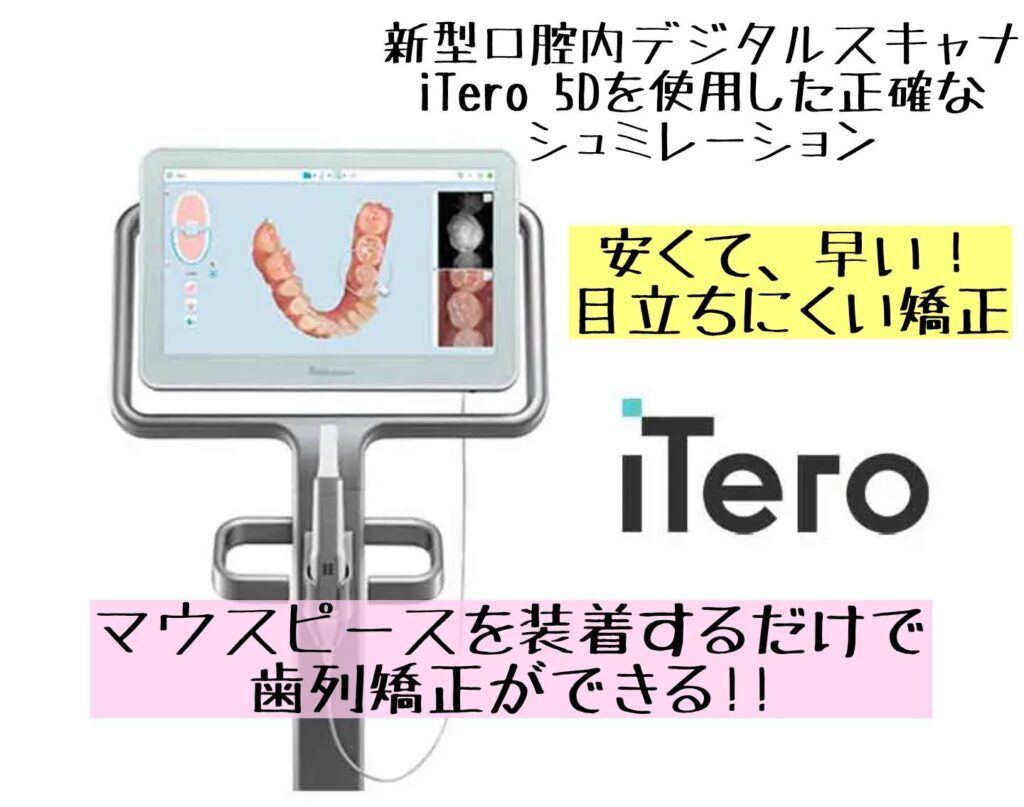 最新機器 iTero(アイテロ) を導入しています