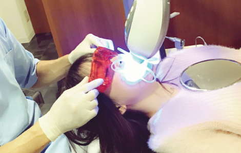 ホワイトニング