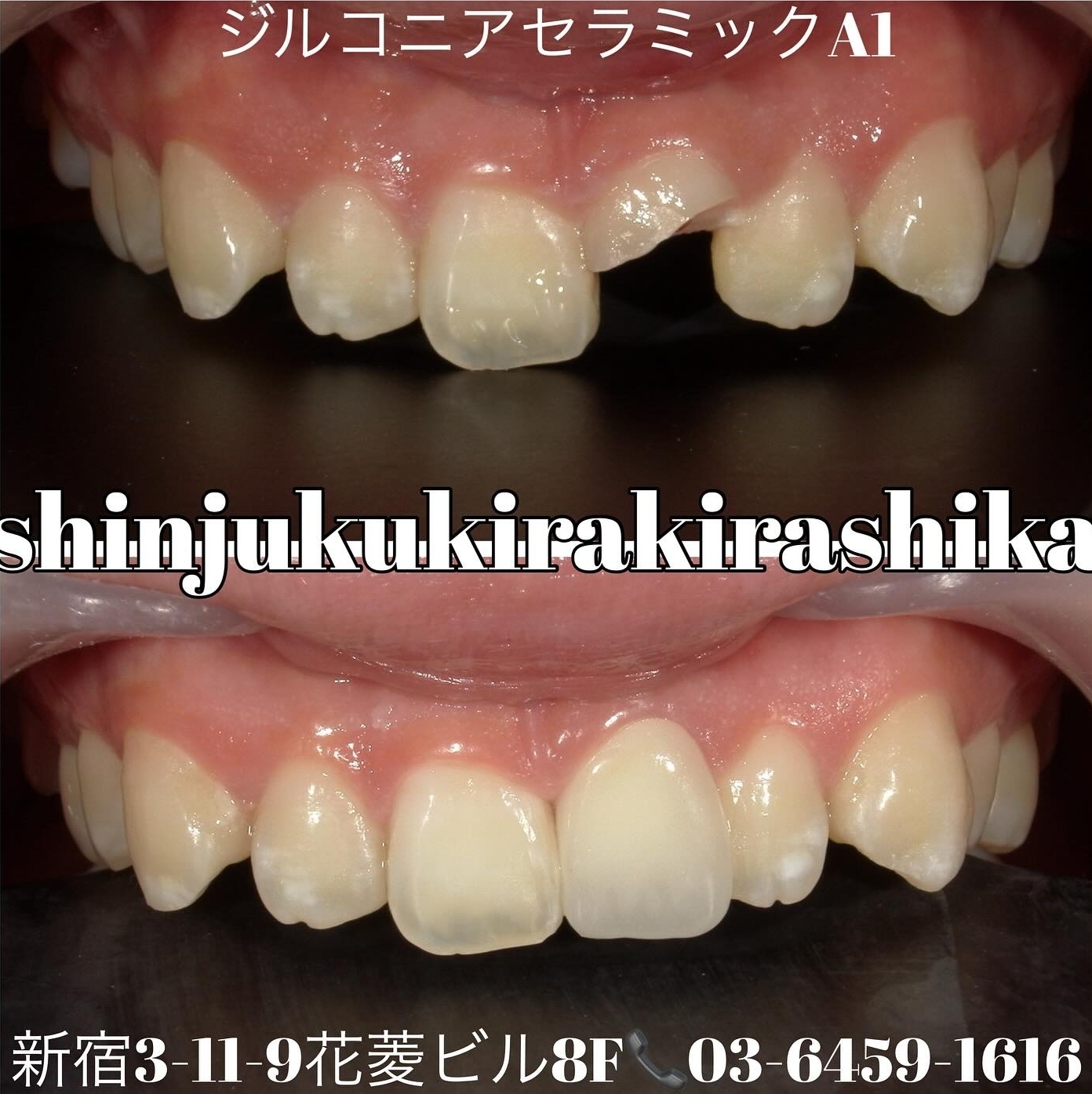 当日処置も可能です!!