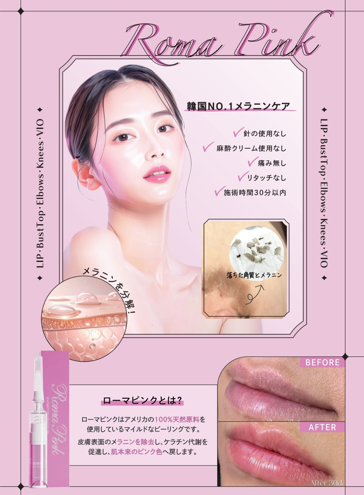 ローマピンク導入致しました！