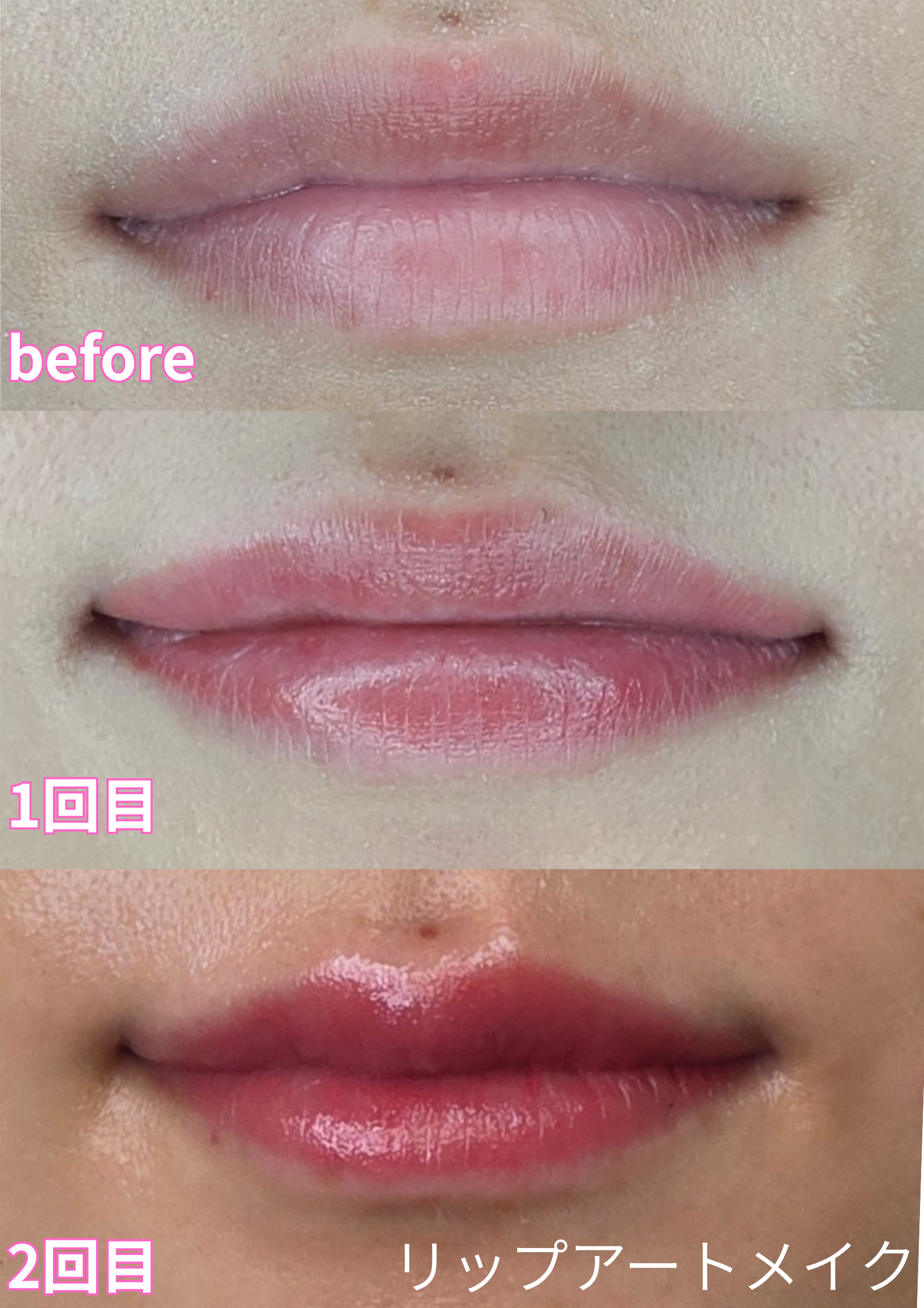 リップアートメイク症例💋