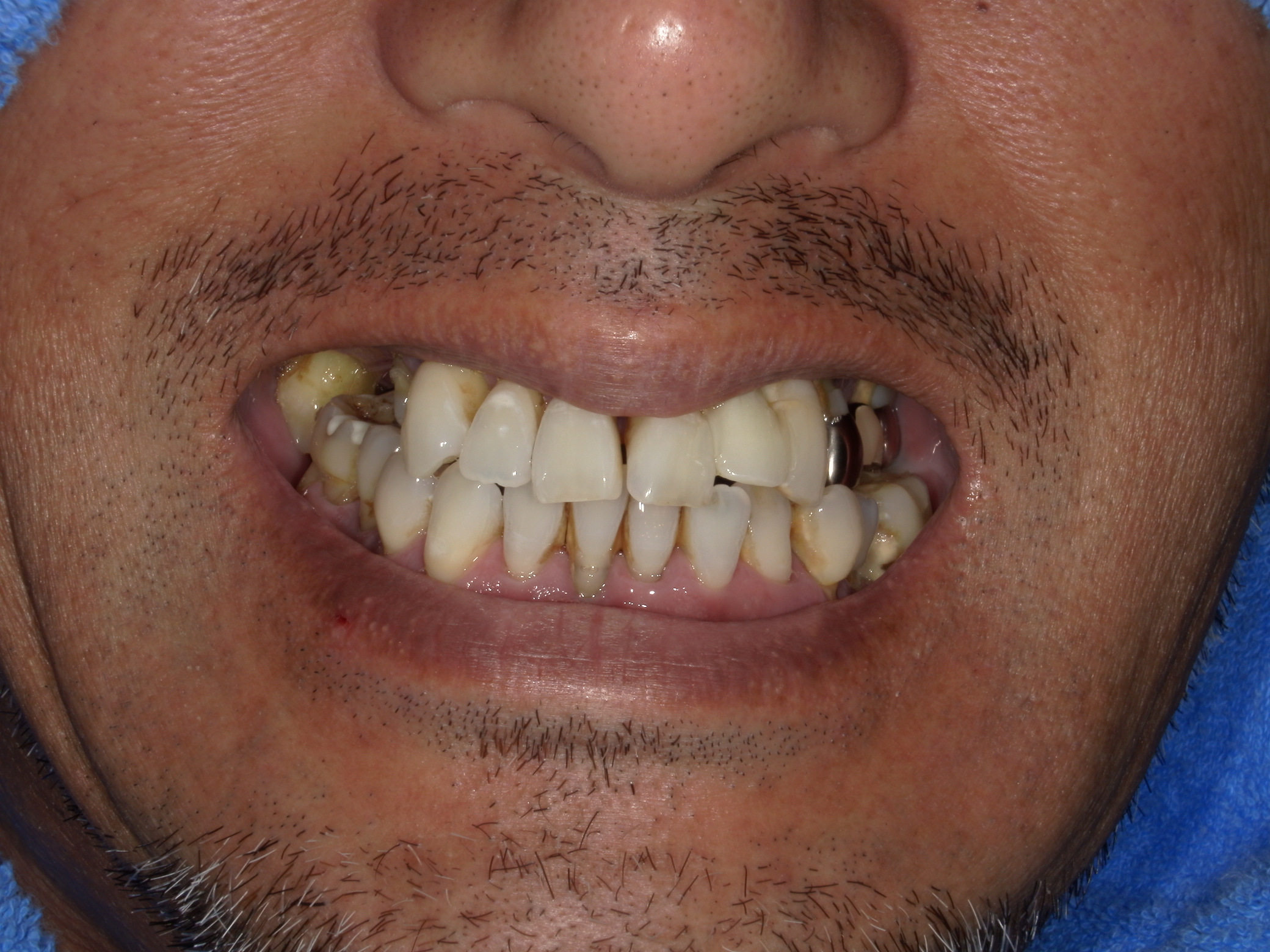 モニター患者様2