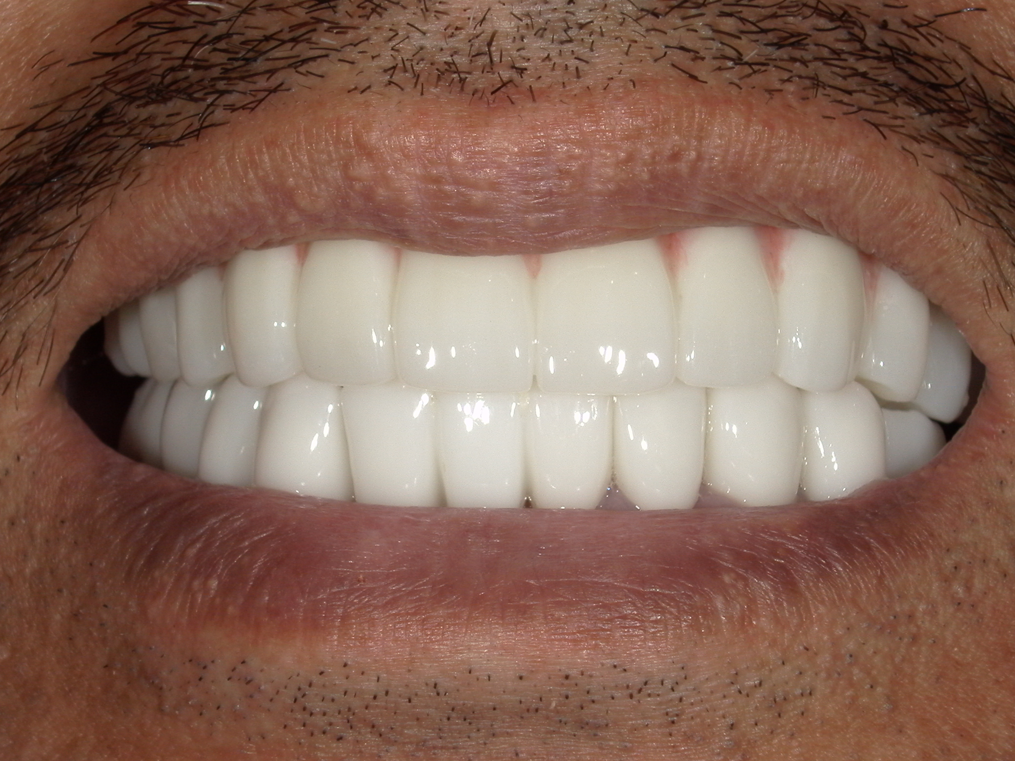 モニター患者様2