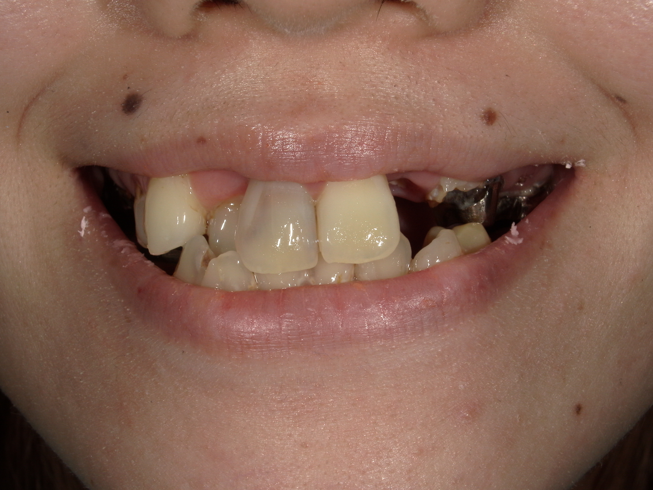 モニター患者様1