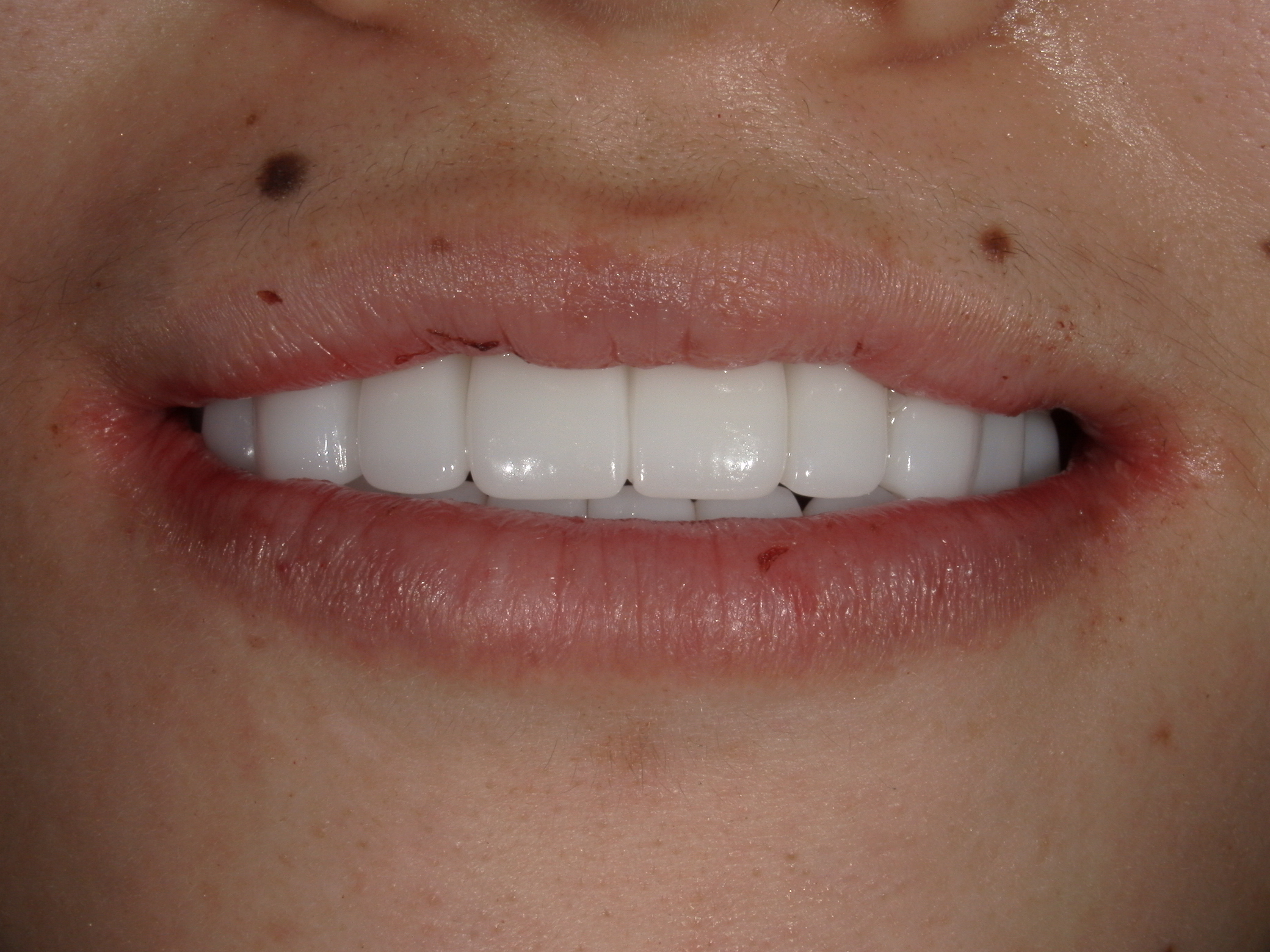 モニター患者様1