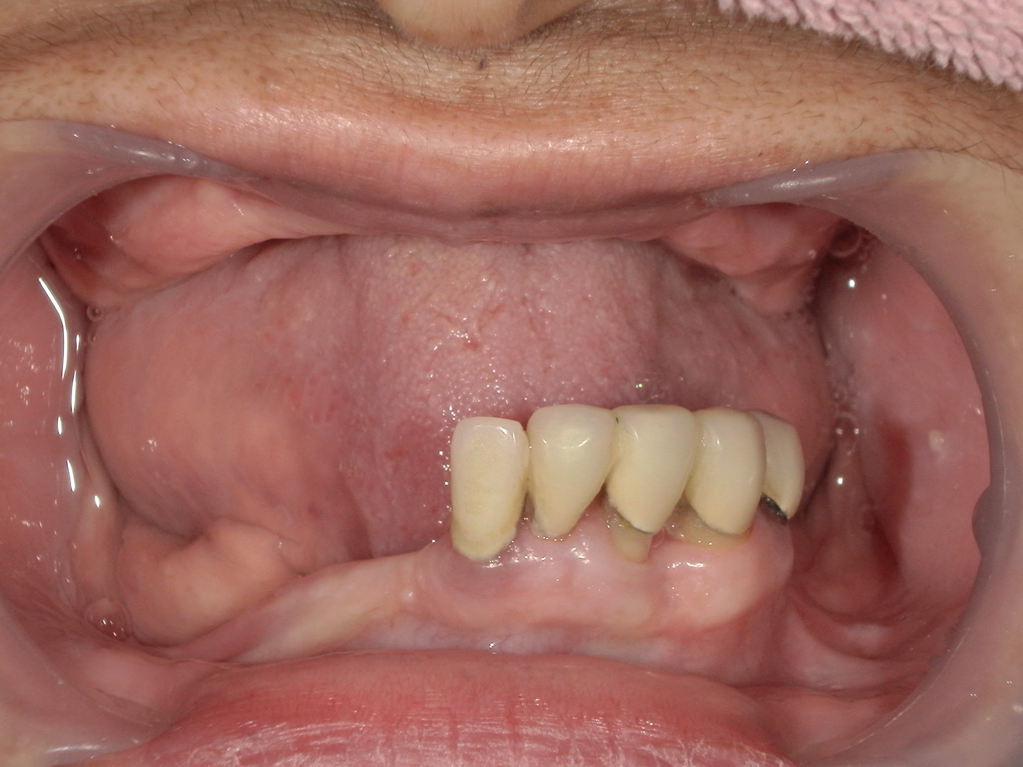 モニター患者様3