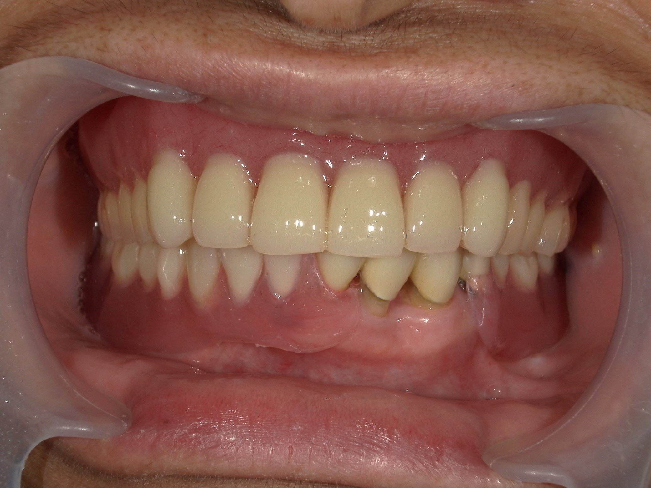 モニター患者様3